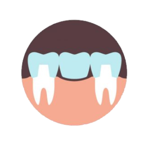 Προσθετική