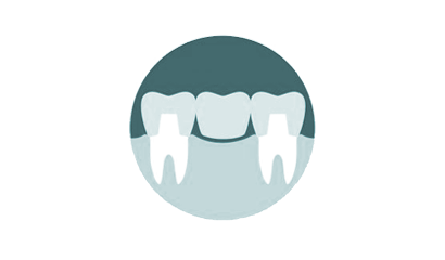 Προσθετική