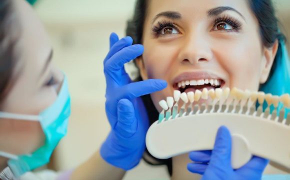 Λεύκανση δοντιών: μύθοι και πραγματικότητες